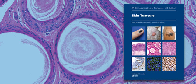 【未開封】WHO Classification of Tumours of En WHO Classification of Tumours of Haematopoietic and Lymphoid